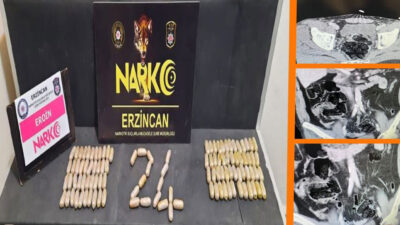 Haber: Muhammed Enes SEVİLİR Erzincan’da narkotik ekipleri, mide ve bağırsaklarında