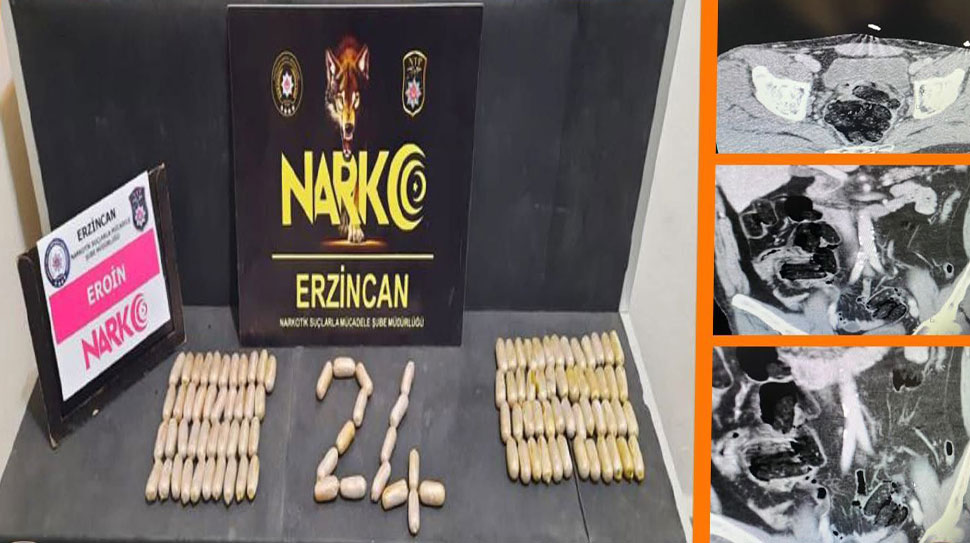 Haber: Muhammed Enes SEVİLİR Erzincan’da narkotik ekipleri, mide ve bağırsaklarında