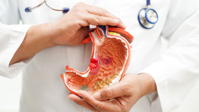 Mide kanseri, H. Pylori enfeksiyonu ve kronik mide hastalıkları gibi